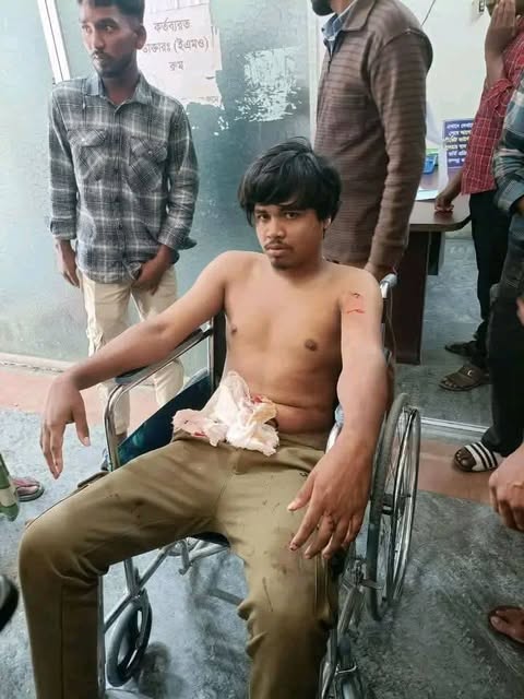 ডিমলা জেলা পরিষদ স্কুল এন্ড কলেজে শিক্ষার্থী ছুরি আঘাতে এলাকায় চাঞ্চল্য