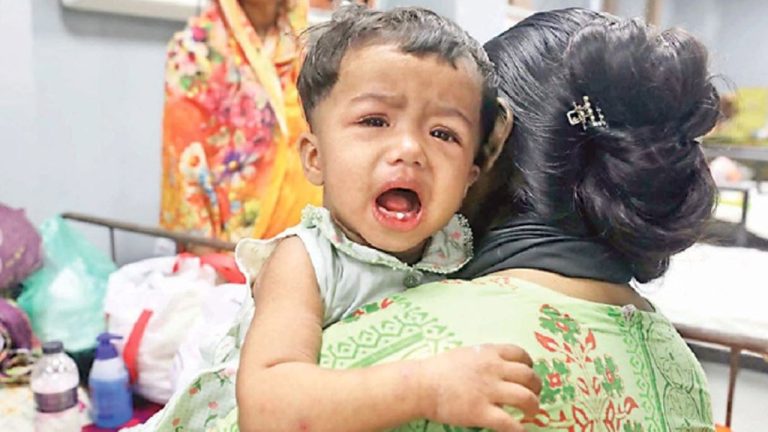 হাম ও উপসর্গে আরো ৫ জনের মৃত্যু