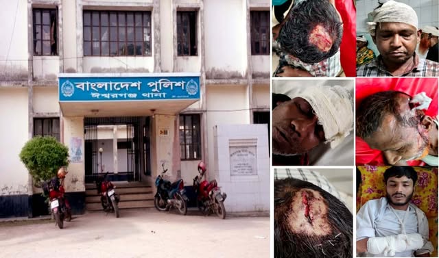 ধান কেটে বাড়ি ফেরার পথে প্রতিপক্ষের হামলায় আহত ১০, দুইজনের অবস্থা আশঙ্কাজনক