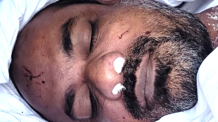 মরদেহে ও স্ত্রীর গালে আঘাতের দাগ: কেন্দুয়ায় গাড়িচালকের মৃত্যু ঘিরে রহস্য