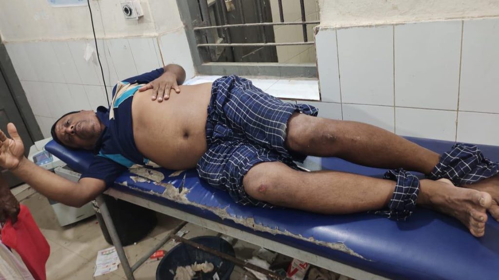 কেন্দুয়ায় ফেসবুক স্ট্যাটাসের জেরে বিএনপি নেতার ওপর হামলা