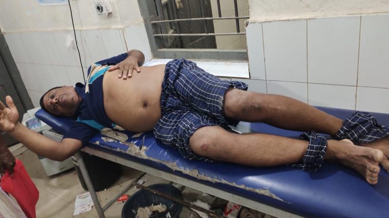 কেন্দুয়ায় ফেসবুক স্ট্যাটাসের জেরে বিএনপি নেতার ওপর হামলা