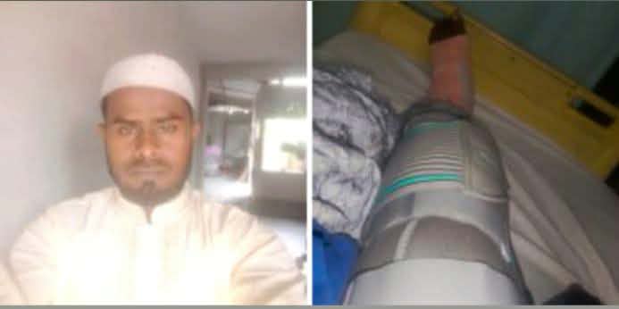 ডিমলার মতির বাজারের গাছ ব্যবসায়ী সালাম সড়ক দুর্ঘটনায় আহত, সুস্থতায় দোয়া কামনা